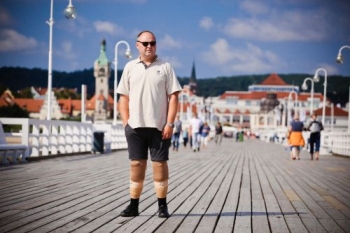 Foto protezy